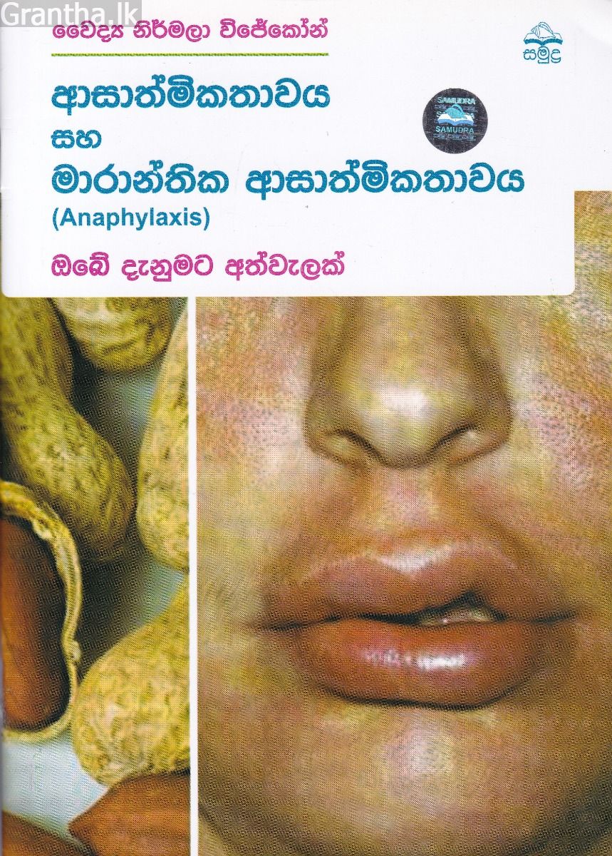ආසාත්මිකතාවය සහ මාරාන්තික ආසාත්මිකතාවය
